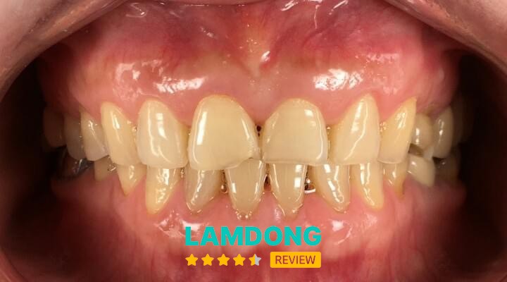 Nha Khoa Thánh Tâm - Bảo Lộc – 10 Nguyễn Tri Phương, Bảo Lộc